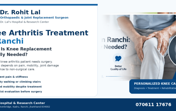 Knee Arthritis Treatment in Ranchi